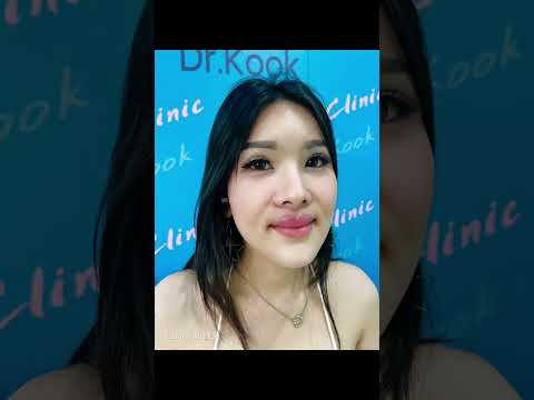 Upper lip lift หมอกุ๊ก Millet clinic
